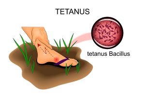 illustration of the foot injury. the risk of tetanus