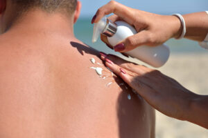 Hand of a woman applying sun cream on a male back with sunscreen before sunbathing at the beach. Sunscreen lotion on beach. Healthy skin. Summer vacation